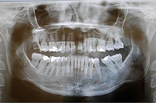 clinica-dental-hermosin-6